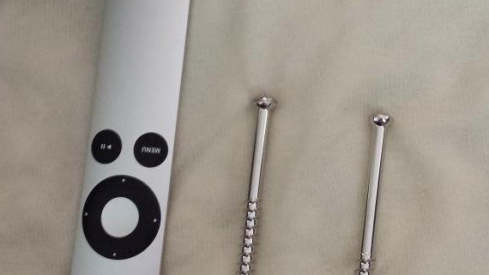 Kyle Berger's Leg-Screws