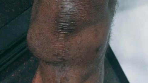 LeCharles Bentley's knee.